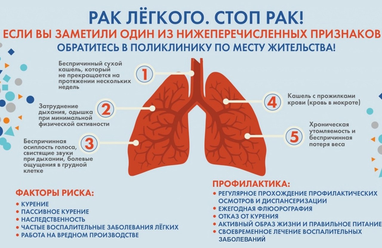 В Югре врач назвал симптомы рака лёгких на ранних стадиях